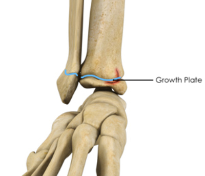 What Causes One Leg To Be Shorter Than The Other Chiropractor Near